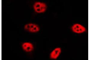 ABIN6274016 staining LOVO by IF/ICC. (Histone H2A 抗体  (acLys9))