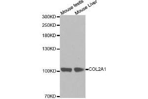Western blot analysis of extracts of various cell lines, using COL2A1 antibody. (COL2A1 抗体  (AA 873-1072))