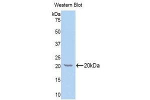 Western Blotting (WB) image for anti-Galactosylceramidase (GALC) (AA 375-535) antibody (ABIN1176550) (GALC 抗体  (AA 375-535))