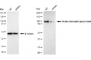 Western blotting analysis using myelin associated glycoprotein antibody (ABIN7799508). (Recombinant MAG 抗体)