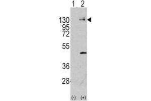 Western blot analysis of PDGFR antibody and 293 cell lysate (2 ug/lane) either nontransfected (Lane 1) or transiently transfected with the PDGFRA gene (2). (PDGFRA 抗体  (AA 698-727))