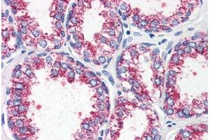 Prostate, Human: Formalin-Fixed, Paraffin-Embedded (FFPE) (CCKAR 抗体  (Internal Region))