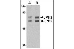 Western blot analysis of JPH2 in mouse brain tissue lysate with JPH2 antibody at (A) 1 and (B) 2 µg/ml (Junctophilin 2 抗体  (C-Term))