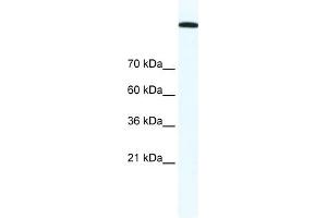 TOP2A antibody (20R-1304) used at 1. (Topoisomerase II alpha 抗体  (C-Term))