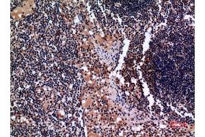 Immunohistochemistry (IHC) analysis of paraffin-embedded Human Lymph Gland, antibody was diluted at 1:100. (Cytokeratin 19 抗体  (C-Term))