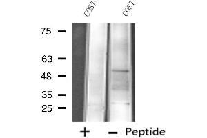 Western blot analysis of extracts from COS7 cells, using Cytochrome P450 4X1 antibody. (CYP4X1 抗体)