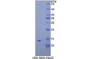 SDS-PAGE analysis of Cow IP10 Protein. (CXCL10 蛋白)