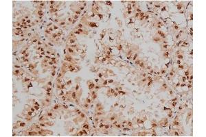 Immunohistochemistry (IHC) image for anti-Sp1 Transcription Factor (SP1) (pThr453) antibody (ABIN6256566)