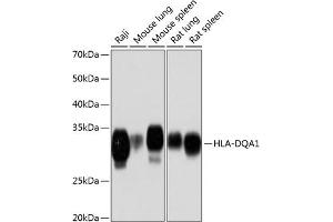Western blot analysis of extracts of various cell lines, using HLA-DQ Rabbit mAb (1252) at 1:1000 dilution. (HLA-DQA1 抗体)