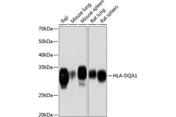 HLA-DQA1 抗体