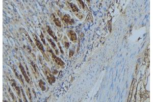 ABIN6277333 at 1/100 staining Human gastric tissue by IHC-P. (IMMT 抗体  (Internal Region))