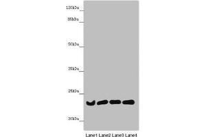 Western blot All lanes: B9D1 antibody at 6. (B9D1 抗体  (AA 1-130))