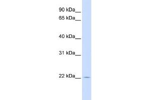 WB Suggested Anti-RHEBL1 Antibody Titration: 0. (RHEBL1 抗体  (Middle Region))