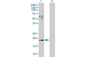 Western Blot analysis of HYI expression in transfected 293T cell line by HYI MaxPab polyclonal antibody. (HYI 抗体  (AA 1-174))