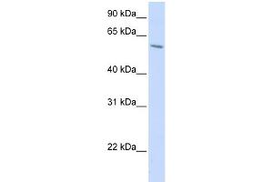 WB Suggested Anti-PORCN Antibody Titration:  0. (PORCN 抗体  (N-Term))