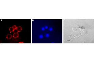 Immunocytochemistry (ICC) image for anti-Solute Carrier Family 6 (Neurotransmitter Transporter, serotonin), Member 4 (SLC6A4) (AA 388-400), (Extracellular) antibody (ABIN7043745)