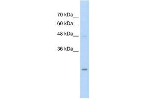 WB Suggested Anti-HIP2 Antibody Titration:  5. (UBE2K 抗体  (N-Term))