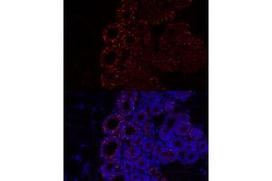 Immunofluorescence analysis of Mouse brown adipose using Perilipin-2 antibody (ABIN7269220) at dilution of 1:100 (40x lens). (ADRP 抗体)