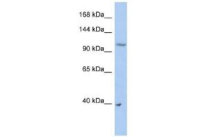 NEDD4L antibody used at 1 ug/ml to detect target protein. (NEDD4-2 抗体  (Middle Region))
