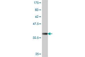 Western Blot detection against Immunogen (37 KDa) . (DLST 抗体  (AA 1-99))