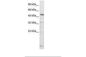 Image no. 1 for anti-DMRT-Like Family A2 (DMRTA2) (AA 247-296) antibody (ABIN6735877) (DMRTA2 抗体  (AA 247-296))