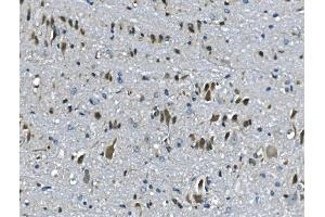 IHC analysis of PAR4/Pawr using anti-PAR4/Pawr antibody (ABIN7599938).