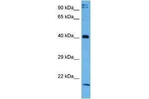 Host:  Rabbit  Target Name:  NFKBIB  Sample Tissue:  Mouse Testis  Antibody Dilution:  1ug/ml (NFKBIB 抗体  (Middle Region))