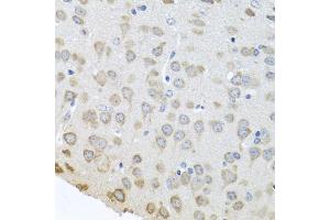 Immunohistochemistry of paraffin-embedded mouse brain using PABPC4 antibody (ABIN5973544) at dilution of 1/100 (40x lens).