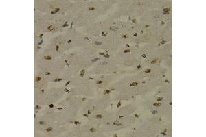 Immunohistochemistry of paraffin-embedded rat heart using NFKB2 antibody at dilution of 1:200 (400x lens). (NFKB2 抗体)