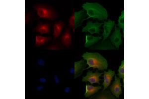 ABIN6259438 and ABIN6276268 staining  cells by IF/ICC.
