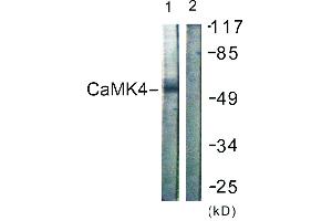 Immunohistochemistry analysis of paraffin-embedded human brain tissue using CaMK4 (Ab-196/200) antibody. (CAMK4 抗体  (Thr196))