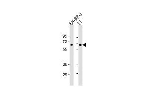 All lanes : Anti-SLC5A8 Antibody (C-Term) at 1:1000 dilution Lane 1: SK-BR-3 whole cell lysate Lane 2: TT whole cell lysate Lysates/proteins at 20 μg per lane. (SLC5A8 抗体  (AA 579-609))