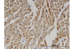 Immunoperoxidase of monoclonal antibody to DECR1 on formalin-fixed paraffin-embedded human heart. (DECR1 抗体  (AA 236-335))