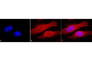 Immunocytochemistry/Immunofluorescence analysis using Rabbit Anti-Alpha B Crystallin Polyclonal Antibody (ABIN361836 and ABIN361837). (CRYAB 抗体)