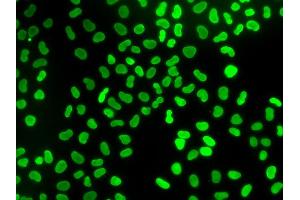 Immunofluorescence analysis of U2OS cells using TMPO antibody. (Thymopoietin 抗体)