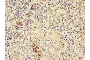 Immunohistochemistry of paraffin-embedded human pancreatic tissue using ABIN7148714 at dilution of 1:100 (CTP Synthase 抗体  (AA 300-554))