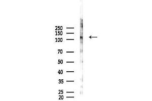 anti-Fibroblast Growth Factor Receptor 1 (FGFR1) (C-Term) antibody