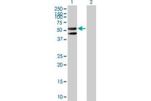 Western Blot analysis of CPM expression in transfected 293T cell line by CPM MaxPab polyclonal antibody. (CPM 抗体  (AA 1-443))