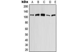 Western blot analysis of AE4 expression in MCF7 (A), HeLa (B), HEK293T (C), SP2/0 (D), PC12 (E) whole cell lysates.