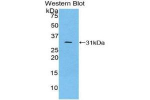 Western Blotting (WB) image for anti-Inhibitory Subunit of NF-KappaB zeta (AA 414-654) antibody (ABIN1859324) (Inhibitory Subunit of NF-KappaB zeta (AA 414-654) 抗体)