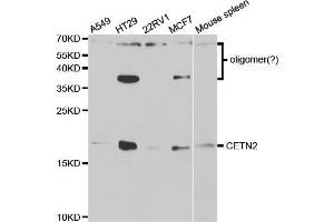 Western Blotting (WB) image for anti-Centrin, EF-Hand Protein, 2 (CETN2) antibody (ABIN1876585) (CETN2 抗体)