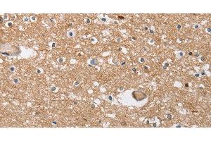 Immunohistochemistry of paraffin-embedded Human brain tissue using SOCS2 Polyclonal Antibody at dilution 1:40 (SOCS2 抗体)