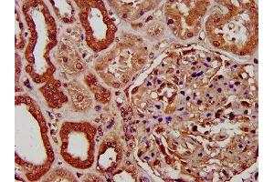 IHC image of ABIN7154344 diluted at 1:200 and staining in paraffin-embedded human kidney tissue performed on a Leica BondTM system. (PIGV 抗体  (AA 400-469))