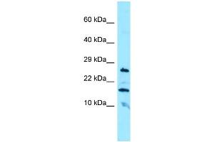 WB Suggested Anti-CBLN3 Antibody Titration: 1. (CBLN3 抗体  (N-Term))