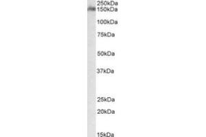 Image no. 1 for anti-CUB and Sushi Multiple Domains 1 (CSMD1) (Internal Region) antibody (ABIN487986) (CSMD1 抗体  (Internal Region))