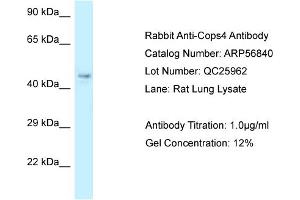 Western Blotting (WB) image for anti-COP9 Signalosome Subunit 4 (COPS4) (N-Term) antibody (ABIN970429) (COPS4 抗体  (N-Term))