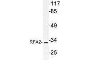 Western blot analysis of RFA2 antibody in extracts from HepG2 cells. (RPA2 抗体  (AA 115-129))