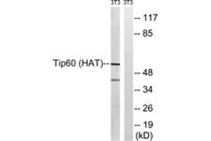 Western blot analysis of extracts from NIH-3T3 cells, treated with starved 24h, using Tip60 (Ab-90) Antibody. (KAT5 抗体  (AA 56-105))