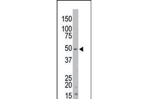 Antibody is used in Western blot to detect STK35 in mouse kidney tissue lysate. (STK35 抗体  (AA 374-404))
