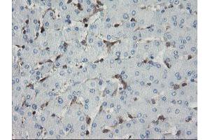 Immunohistochemical staining of paraffin-embedded Human liver tissue using anti-GIMAP4 mouse monoclonal antibody. (GIMAP4 抗体)